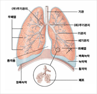 폐렴