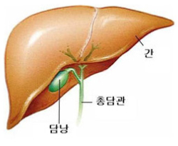 담도 질환